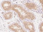 KLHL17 Antibody in Immunohistochemistry (Paraffin) (IHC (P))
