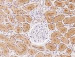 KLHL17 Polyclonal Antibody