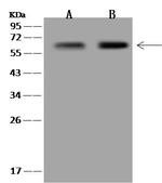 LGSN Polyclonal Antibody