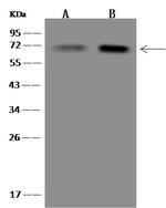 KBTBD12 Polyclonal Antibody