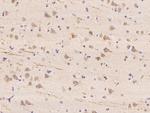 WBSCR17 Polyclonal Antibody