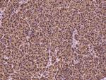 HEATR4 Polyclonal Antibody