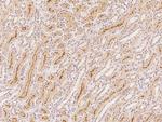 C1orf198 Polyclonal Antibody