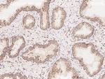 COQ2 Polyclonal Antibody