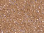 SV2B Polyclonal Antibody