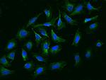 NBPF15 Polyclonal Antibody