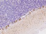 NBPF15 Antibody in Immunohistochemistry (Paraffin) (IHC (P))