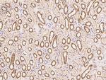 SLX1A Polyclonal Antibody