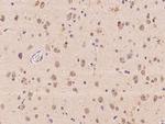MA2 Polyclonal Antibody