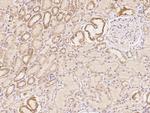 PCBP4 Polyclonal Antibody