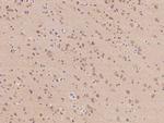 PCBP4 Antibody in Immunohistochemistry (Paraffin) (IHC (P))