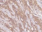 SLC44A1 Polyclonal Antibody