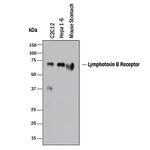 LTBR Polyclonal Antibody