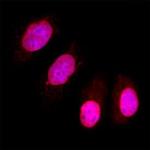 PPM1D Polyclonal Antibody