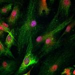 HOXD10 Polyclonal Antibody