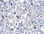 BMP-8 Polyclonal Antibody