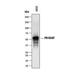 Thymidine Phosphorylase Polyclonal Antibody