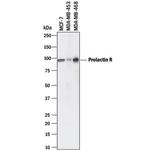Prolactin Receptor Polyclonal Antibody