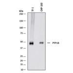 PTP1B Polyclonal Antibody