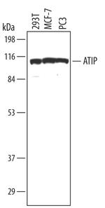 ATRIP Polyclonal Antibody