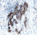 S100A10 Antibody in Immunohistochemistry (Paraffin) (IHC (P))