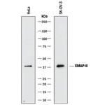 EMAP II Antibody in Western Blot (WB)