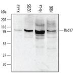 RAD17 Polyclonal Antibody