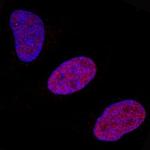 FosB Polyclonal Antibody