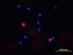 CD8a Antibody in Immunocytochemistry (ICC/IF)