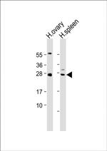 NTF3 Polyclonal Antibody