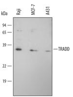 TRADD Antibody in Western Blot (WB)