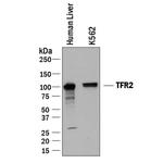 TFR2 Polyclonal Antibody