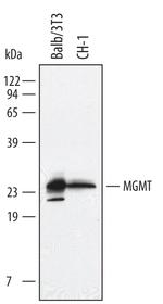 MGMT Polyclonal Antibody