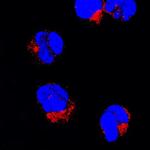 Fyn Polyclonal Antibody