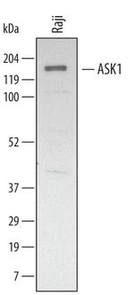 ASK1 Polyclonal Antibody
