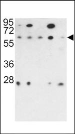 PPP2R3B Polyclonal Antibody