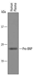 pro-Brain Natriuretic Peptide Polyclonal Antibody