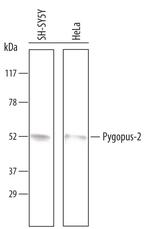 PYGO2 Polyclonal Antibody