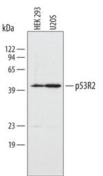 p53R2 Polyclonal Antibody
