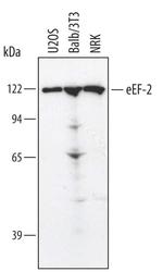 EEF2 Polyclonal Antibody