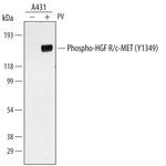 Phospho-c-Met (Tyr1349) Polyclonal Antibody