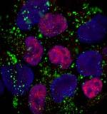 UTF1 Polyclonal Antibody