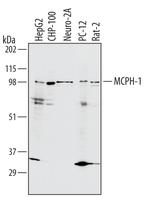 MCPH1 Polyclonal Antibody