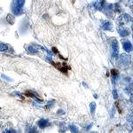 SMAD2 Antibody in Immunohistochemistry (Paraffin) (IHC (P))