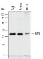 NTAL Polyclonal Antibody