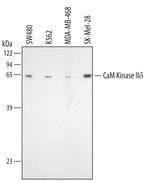 CaMKII delta Polyclonal Antibody
