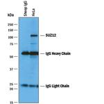 SUZ12 Polyclonal Antibody