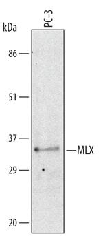 MLX Antibody in Western Blot (WB)