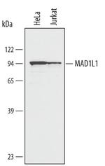 MAD1 Polyclonal Antibody