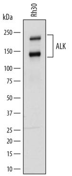 ALK Polyclonal Antibody